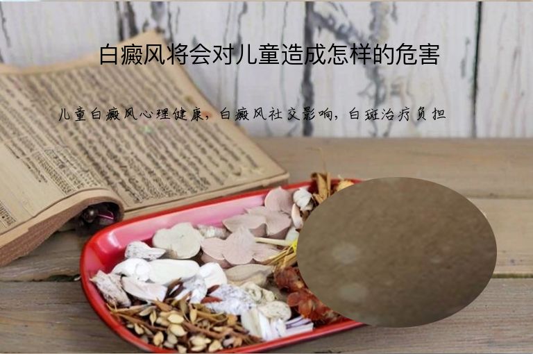 白癜风将会对儿童造成怎样的危害”