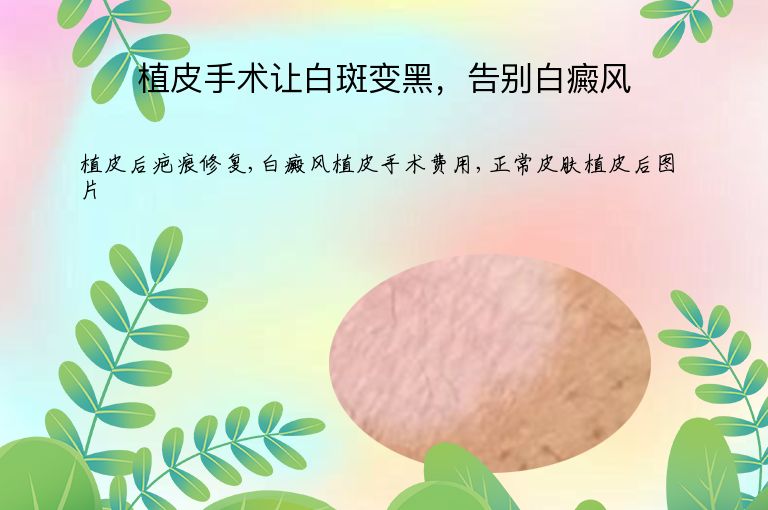 植皮手术让白斑变黑，告别白癜风”