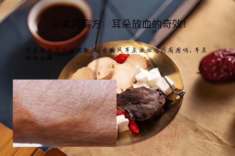 https://www.bdfsjzyy.com/d/file/p/09ae0922f1bd8a0439e6a2cf6c68ada3.jpeg