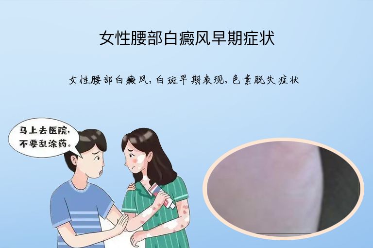 女性腰部白癜风早期症状”