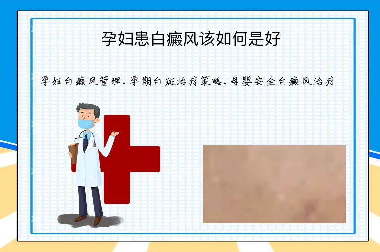 孕妇患白癜风该如何是好”