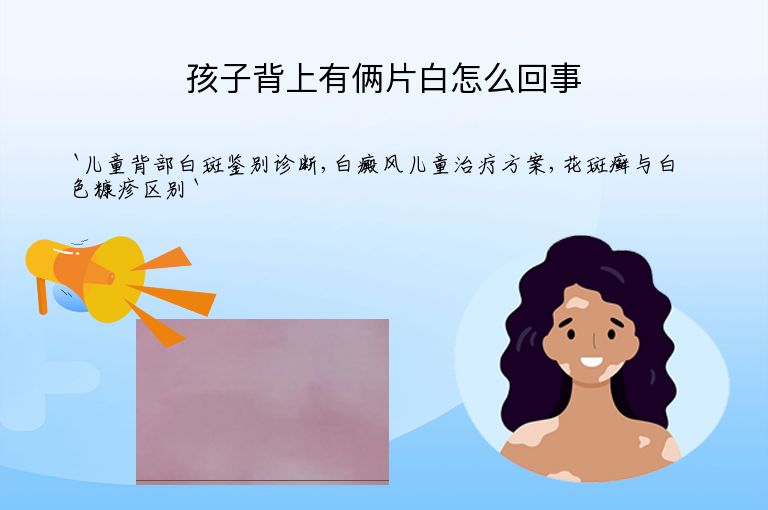 孩子背上有俩片白怎么回事