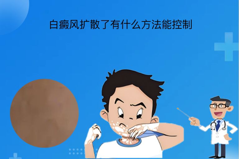 白癜风扩散了有什么方法能控制”