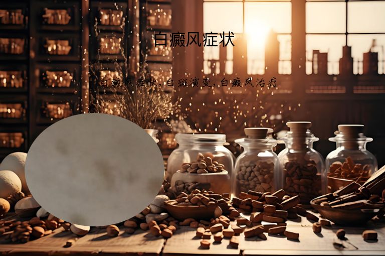白癜风症状”