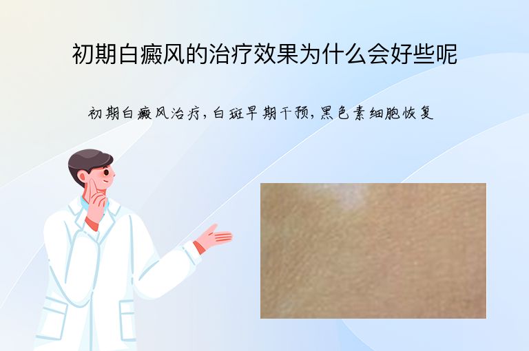 初期白癜风的治疗效果为什么会好些呢”