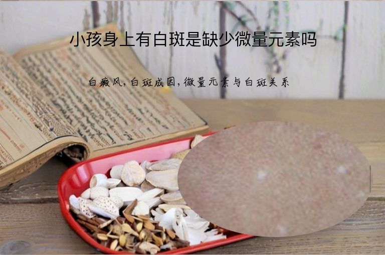小孩身上有白斑是缺少微量元素吗”