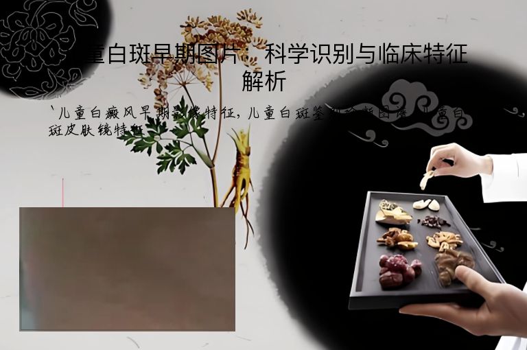 儿童白斑早期图片:科学识别与临床特征解析