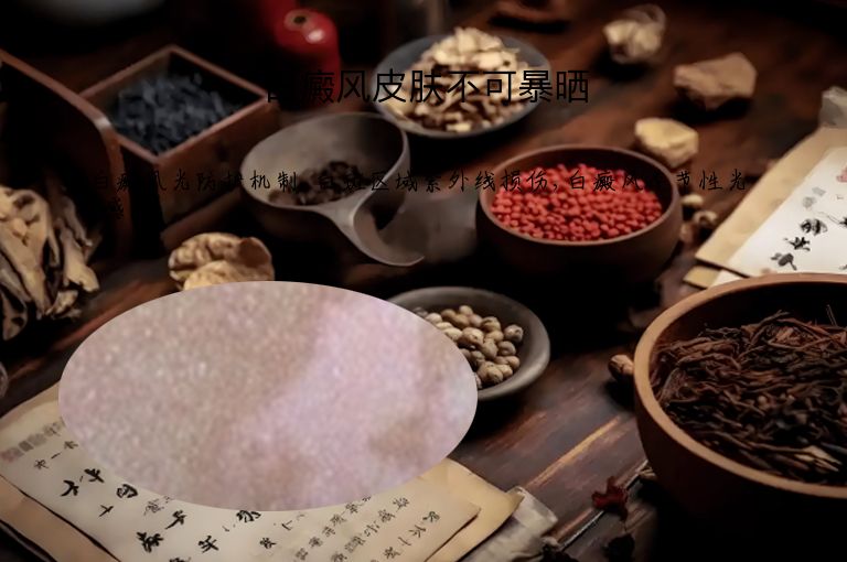 白癜风皮肤不可暴晒