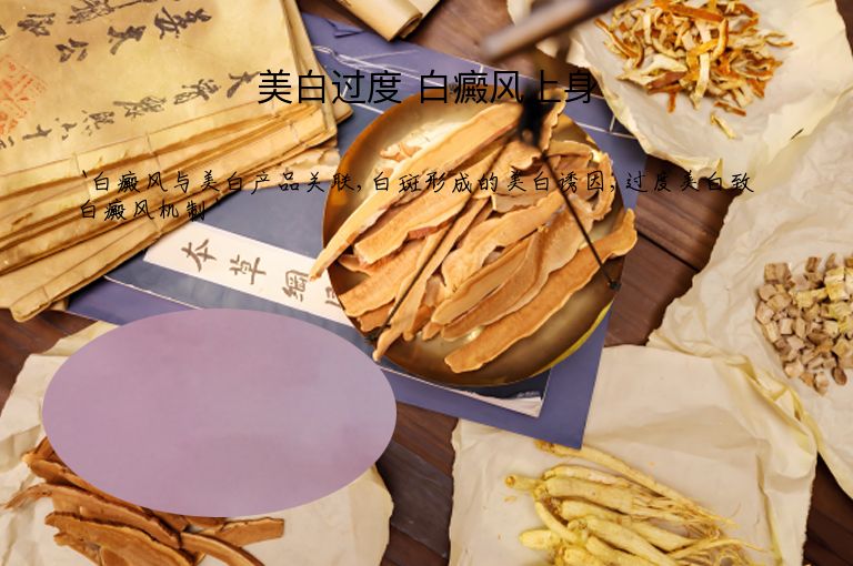 美白过度 白癜风上身”