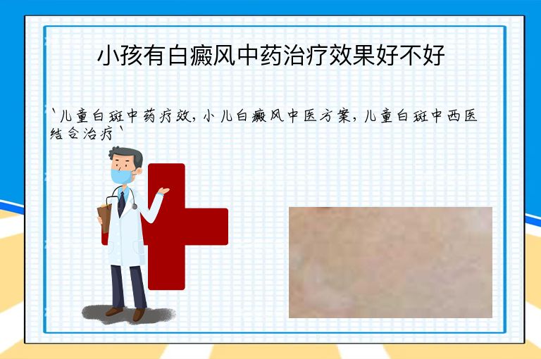 https://www.bdfsjzyy.com/d/file/p/28f57fd9041d69b24bfd056ac935a1fd.jpeg