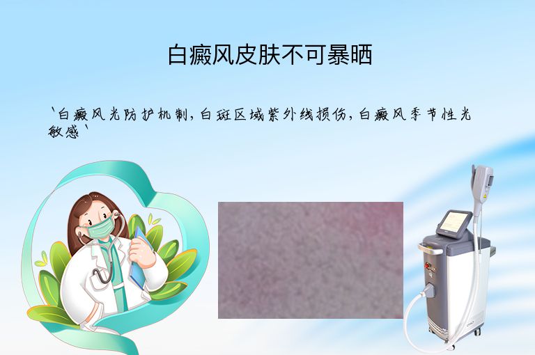白癜风皮肤不可暴晒