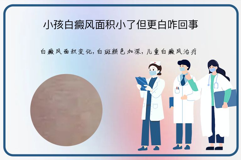 https://www.bdfsjzyy.com/d/file/p/c1a39e5724a7f05e6c71bf365b25f5bb.jpeg
