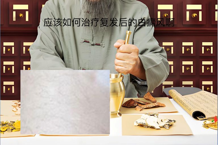 https://www.bdfsjzyy.com/d/file/p/de7e6a78efdee2b837051f7f68a66d14.jpeg