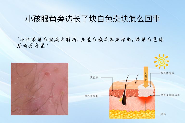 小孩眼角旁边长了块白色斑块怎么回事