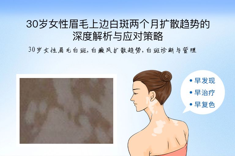 30岁女性眉毛上边白斑两个月扩散趋势的深度解析与应对策略”