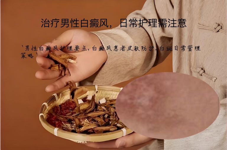 治疗男性白癜风，日常护理需注意