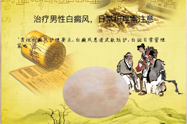 治疗男性白癜风，日常护理需注意