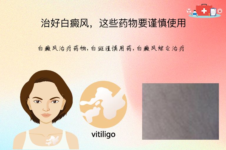 治好白癜风，这些药物要谨慎使用”