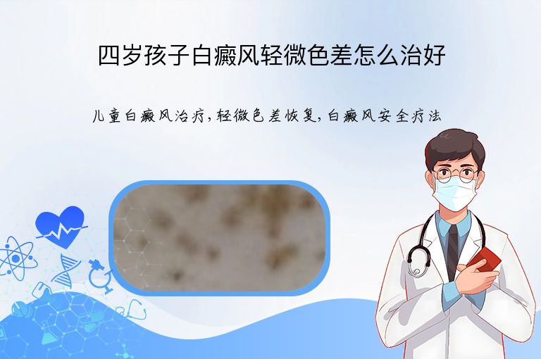 四岁孩子白癜风轻微色差怎么治好”