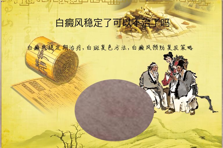 白癜风稳定了可以不治了吗”