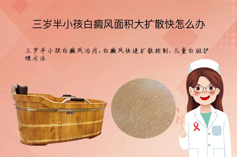 https://www.bdfsjzyy.com/d/file/p/fe62e053fb53c5131d4877f6fb0e2cc1.jpeg