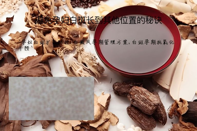 避免孕妇白斑长到其他位置的秘诀