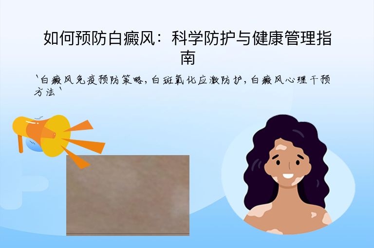 如何预防白癜风：科学防护与健康管理指南