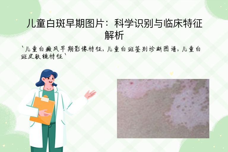 儿童白斑早期图片:科学识别与临床特征解析