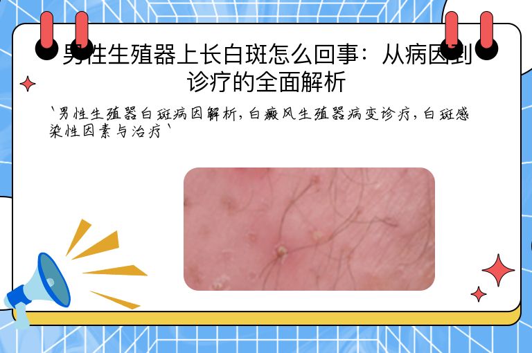 男性生殖器上长白斑怎么回事:从病因到诊疗的全面解析
