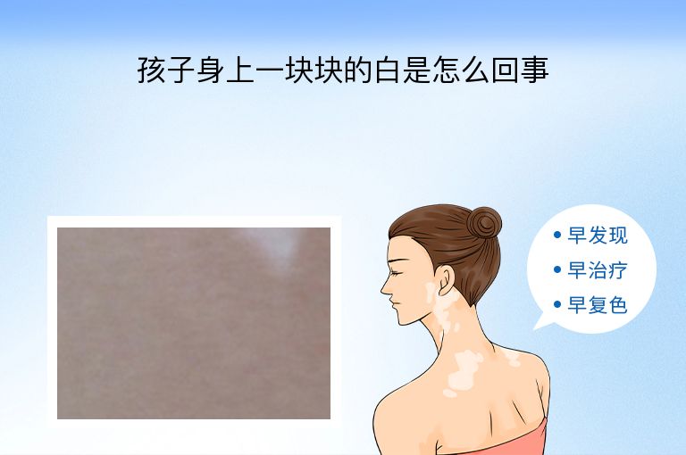 https://www.bdfsjzyy.com/d/file/p/e137584e52957c8dfa99bfd300b2cbc4.jpeg