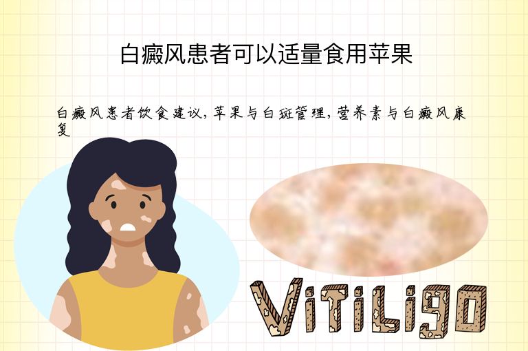 白癜风患者可以适量食用苹果”