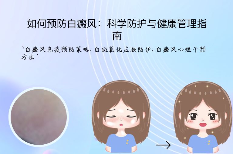如何预防白癜风:科学防护与健康管理指南