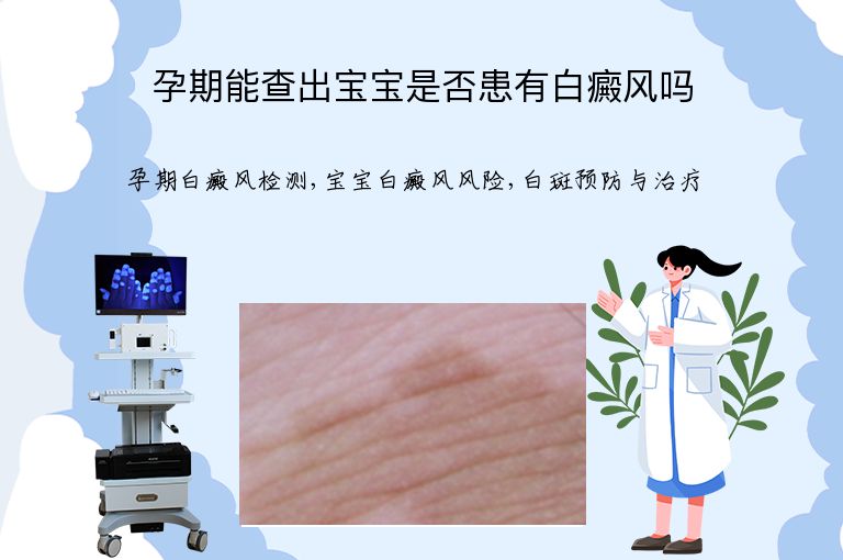 孕期能查出宝宝是否患有白癜风吗”