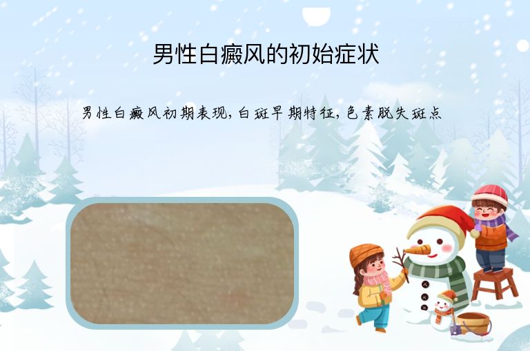男性白癜风的初始症状”
