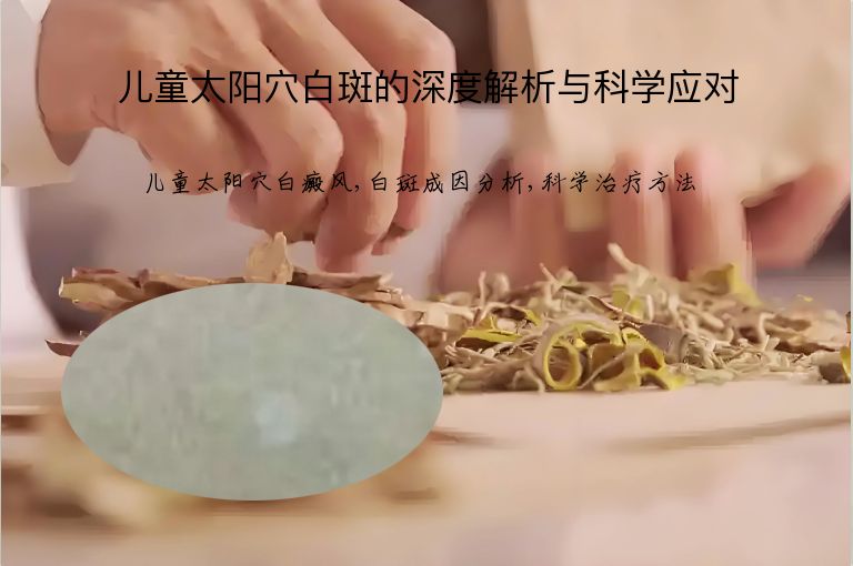 儿童太阳穴白斑的深度解析与科学应对”