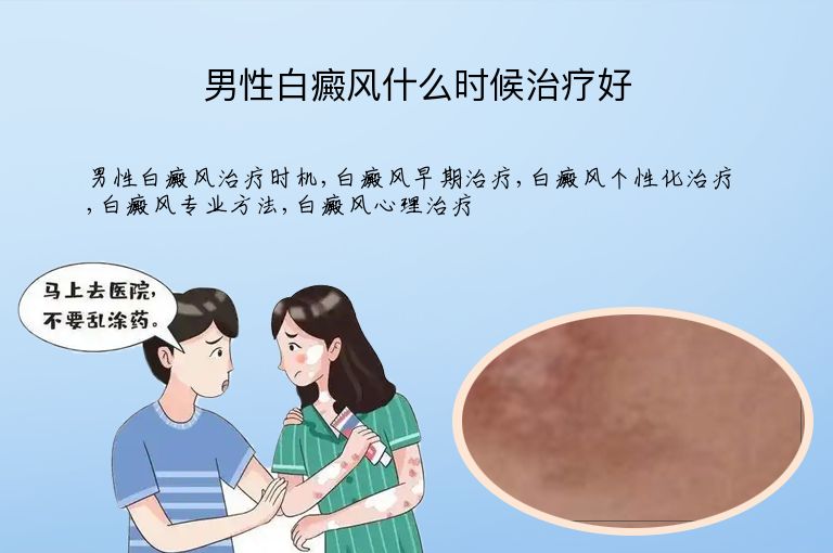 男性白癜风什么时候治疗好”
