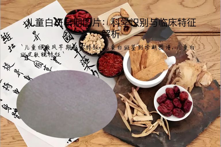 儿童白斑早期图片:科学识别与临床特征解析