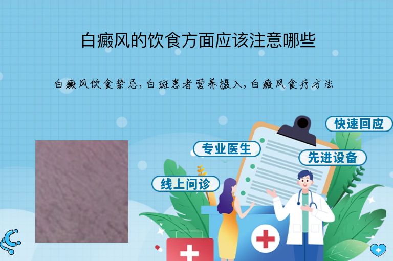 白癜风的饮食方面应该注意哪些”