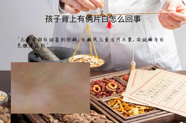 孩子背上有俩片白怎么回事