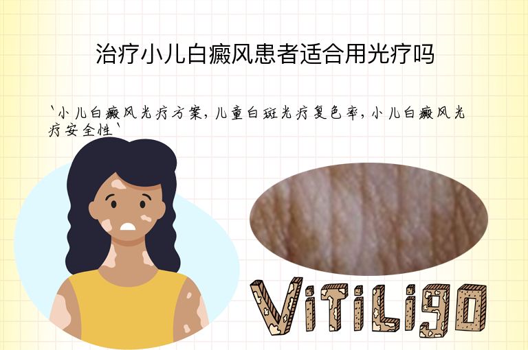 治疗小儿白癜风患者适合用光疗吗