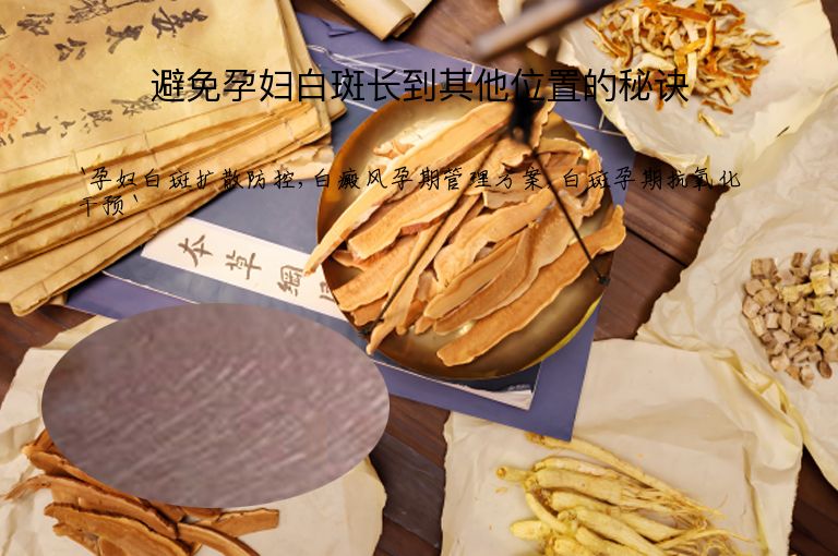 避免孕妇白斑长到其他位置的秘诀