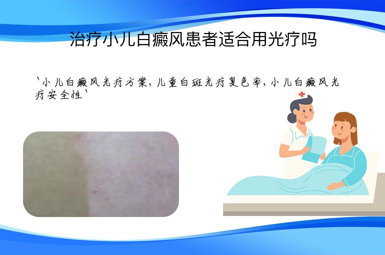治疗小儿白癜风患者适合用光疗吗