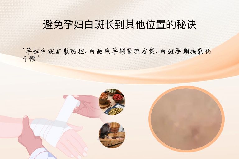 避免孕妇白斑长到其他位置的秘诀