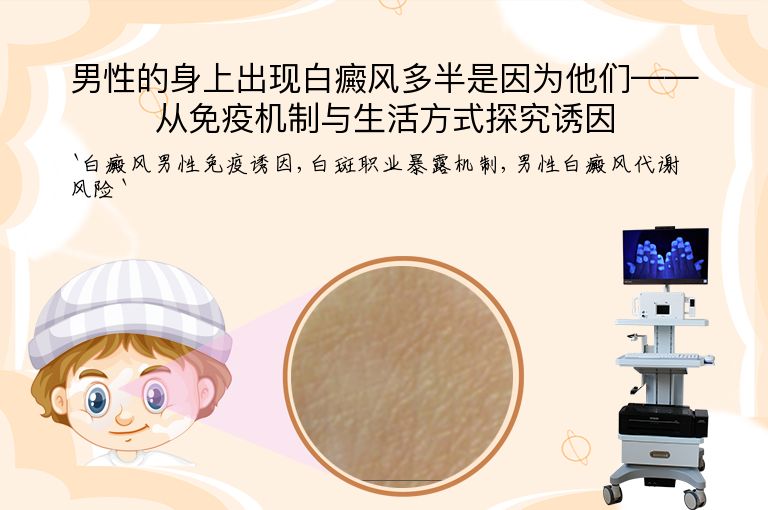 男性的身上出现白癜风多半是因为他们——从免疫机制与生活方式探究诱因