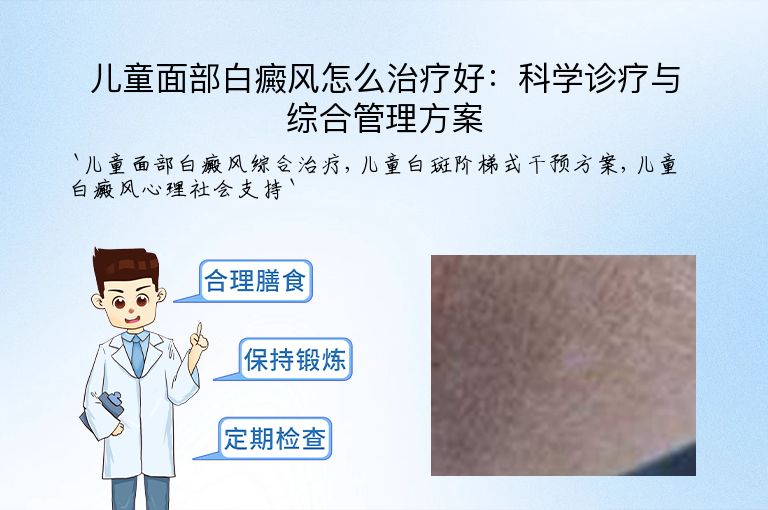儿童面部白癜风怎么治疗好：科学诊疗与综合管理方案”