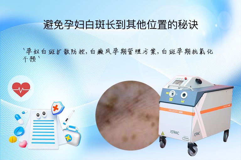 避免孕妇白斑长到其他位置的秘诀