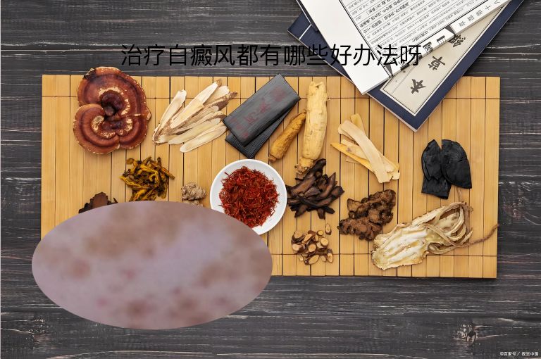 治疗白癜风都有哪些好办法呀”