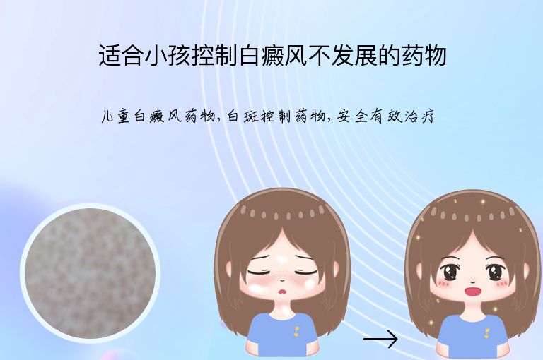 适合小孩控制白癜风不发展的药物”