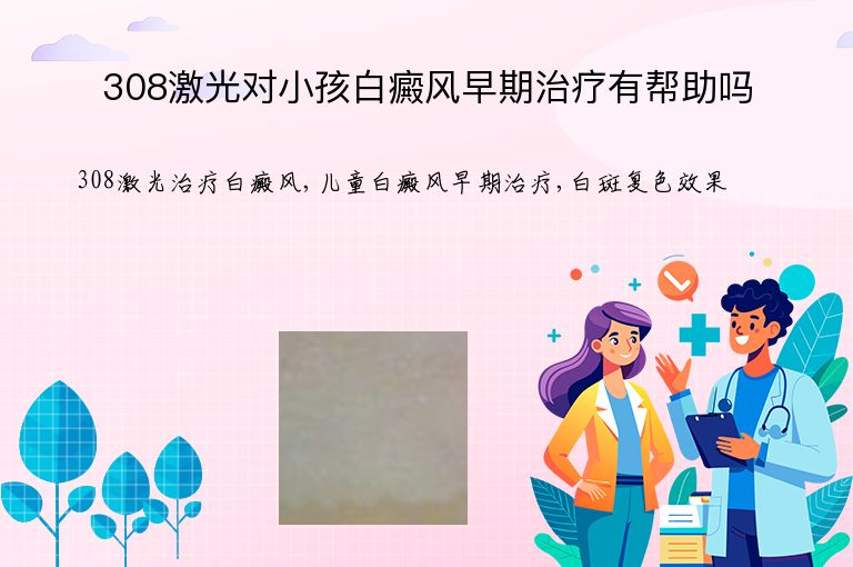 308激光对小孩白癜风早期治疗有帮助吗”