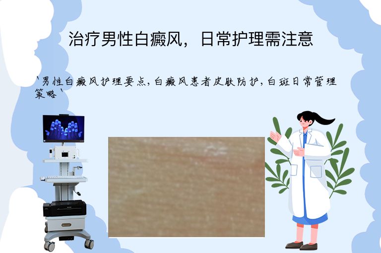 治疗男性白癜风,日常护理需注意